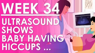 The Pregnancy - Week 34