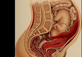 Anterior placenta