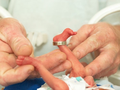 Neonatal deaths - How can we prevent it?